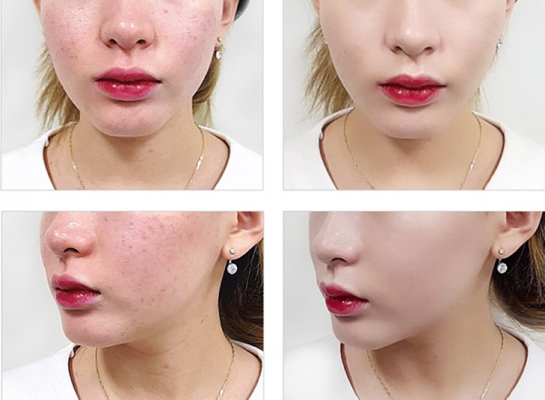 Bình xịt trang điểm UH Bình xịt trang điểm UH
