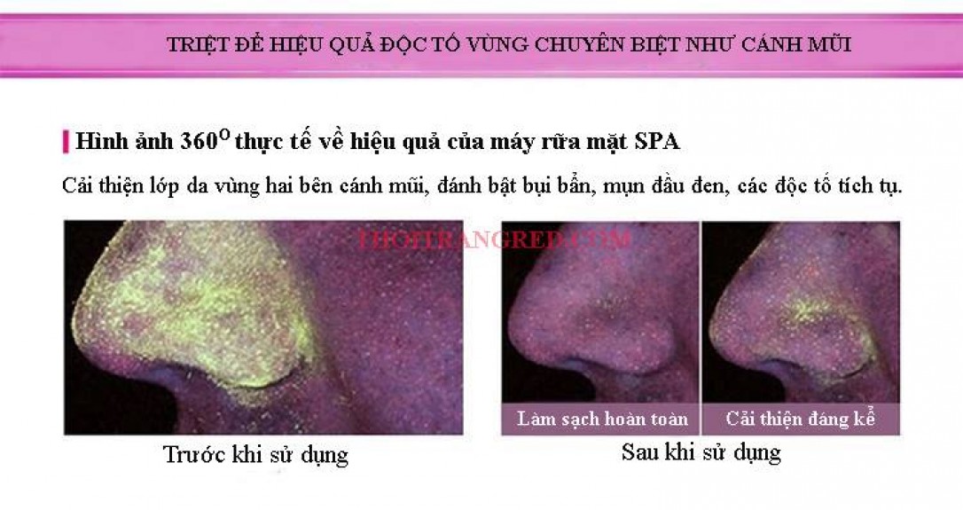 MÁY RỬA MẶT HALIO CẦM TAY VERSION 2 MÁY RỬA MẶT HALIO CẦM TAY VERSION 2